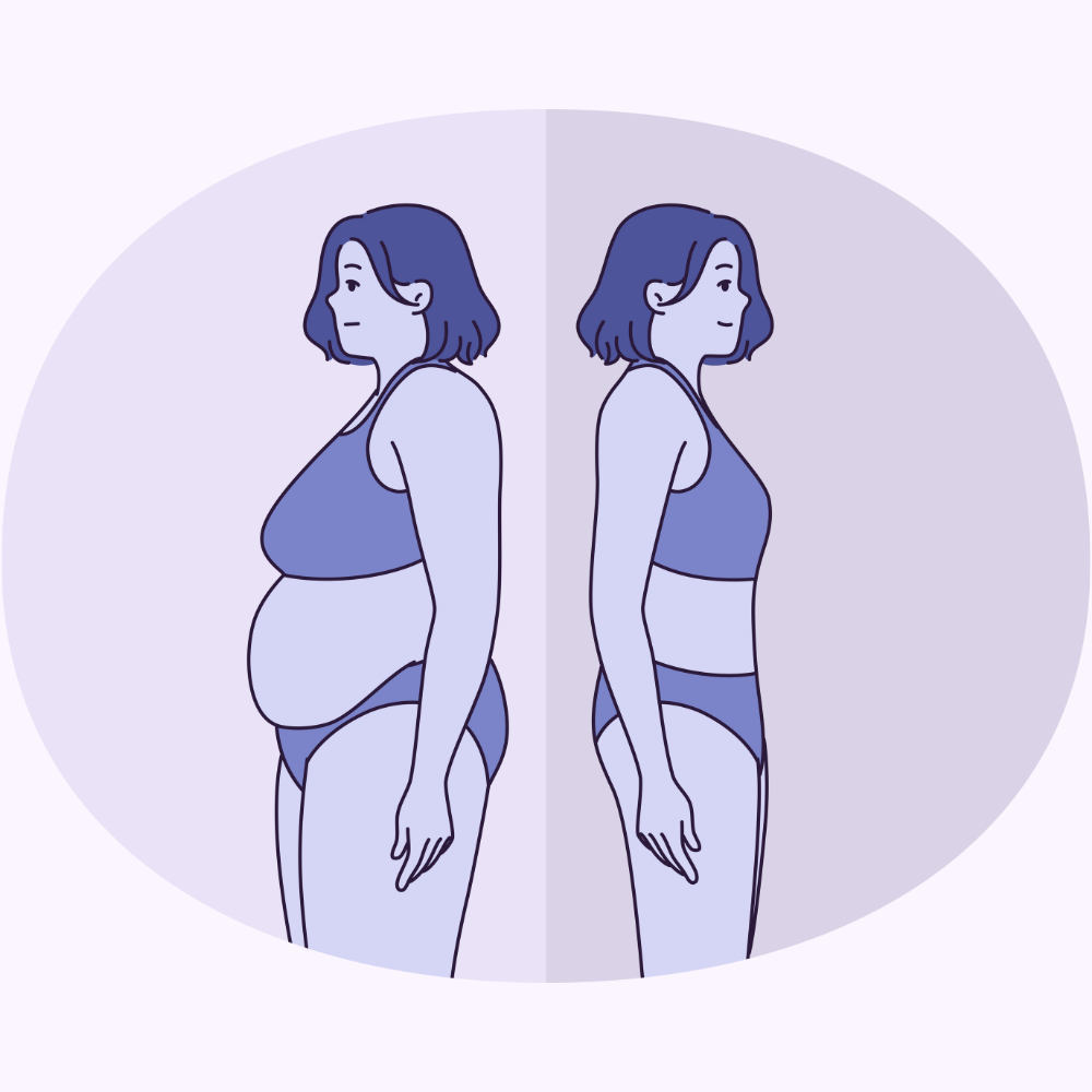 Viszerales Bauchfett – Was es mit deinem Herzen macht